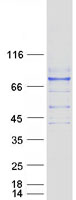 Coomassie blue staining of purified IL17RC protein