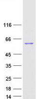Coomassie blue staining of purified SMYD1 protein