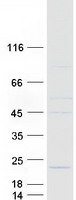 protq8nbd8 tmem229b human recombinant protein