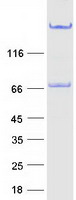 protq8nbj4 golph2 golm1 human recombinant protein