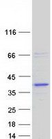 protq8nbn7 rdh13 human recombinant protein