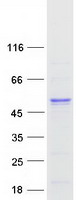 Coomassie blue staining of purified TXNDC5 protein