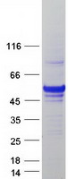 protq8nbz7 uxs 1 uxs1 human recombinant protein