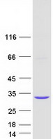 Coomassie blue staining of purified KCTD6 protein