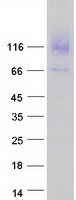 Coomassie blue staining of purified RBBP8NL protein