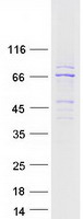 Coomassie blue staining of purified CAMKV protein