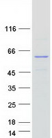Coomassie blue staining of purified SPRYD3 protein