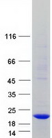 protq8ncu1 c14orf48 linc00521 human recombinant protein
