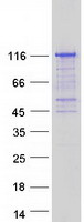protq8nd04 c17orf71 smg8 human recombinant protein