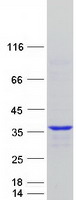 Coomassie blue staining of purified CCNY protein