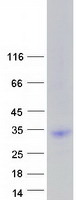 protq8nd94 lrrn4cl human recombinant protein