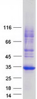protq8ndb6 1 fam156b human recombinant protein