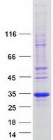 Coomassie blue staining of purified FAM156A protein