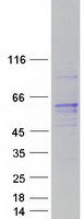Coomassie blue staining of purified RCBTB1 protein