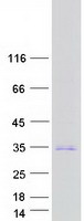 Coomassie blue staining of purified BHLHE23 protein