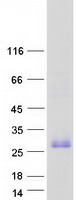 Coomassie blue staining of purified TMEM52 protein