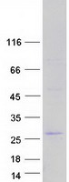 protq8nea4 fbxo36 human recombinant protein