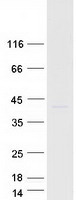 Coomassie blue staining of purified SLC30A7 protein