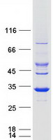 Coomassie blue staining of purified SDR9C7 protein