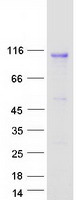 Coomassie blue staining of purified IL17RD protein