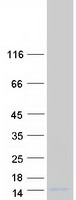 protq8nfr3 sptssb human recombinant protein