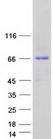 protq8nfy9 kbtbd8 human recombinant protein