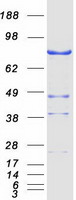 protq8ng66 nek11 human recombinant protein