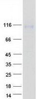 Coomassie blue staining of purified IL31RA protein