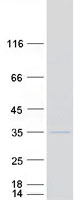 protq8ni29 fbxo27 human recombinant protein