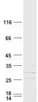 Coomassie blue staining of purified GADD45GIP1 protein