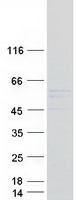 Coomassie blue staining of purified TTC8 protein