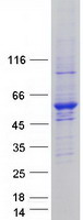 Coomassie blue staining of purified UBA3 protein