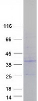 Coomassie blue staining of purified PIGX protein