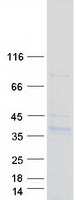 protq8tbg9 synpr human recombinant protein