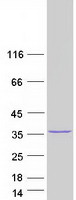Coomassie blue staining of purified METTL6 protein