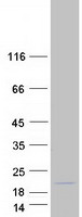 Coomassie blue staining of purified MRPL30 protein
