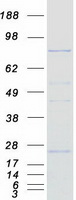 Coomassie blue staining of purified CPT1C protein