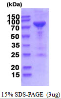 3ug by SDS-PAGE under reducing condition and visualized by coomassie blue stain.