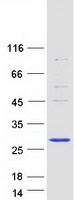 Coomassie blue staining of purified BLOC1S5 protein