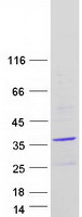 Coomassie blue staining of purified PANK1 protein