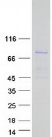 Coomassie blue staining of purified DQX1 protein