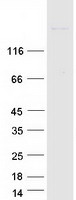 Coomassie blue staining of purified NUP210 protein