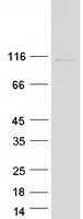 protq8tey7 usp33 human recombinant protein