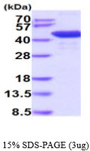 protq8vh37 sdspage mouse hdac8 recombinant protein
