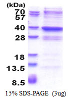 3ug by SDS-PAGE under reducing condition and visualized by coomassie blue stain.