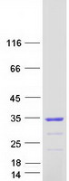 protq8wv22 nsmce1 human recombinant protein
