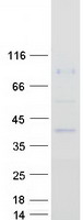 protq8wv60 ptcd2 human recombinant protein