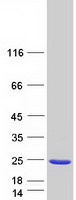 protq8wvj2 nudcd2 human recombinant protein