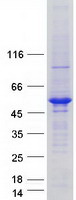 Coomassie blue staining of purified UBE2Q2 protein