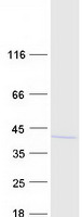 protq8wvy7 ublcp1 human recombinant protein